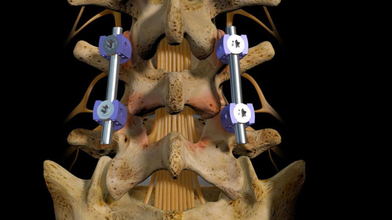 Spine Center Services