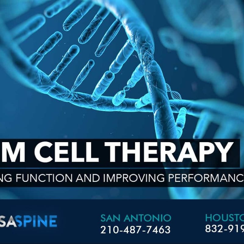 stem cell therapy