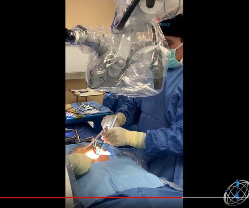 Dr Steven Cyr Minimally Invasive Microdiscectomy