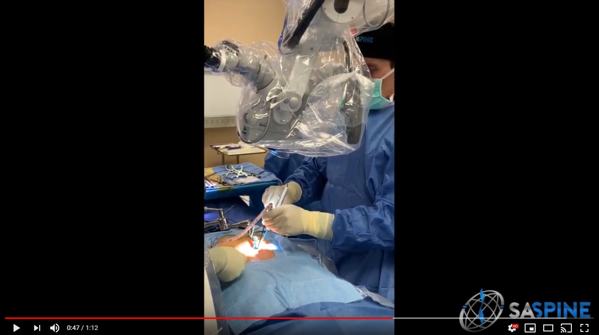 Dr Steven Cyr Minimally Invasive Microdiscectomy