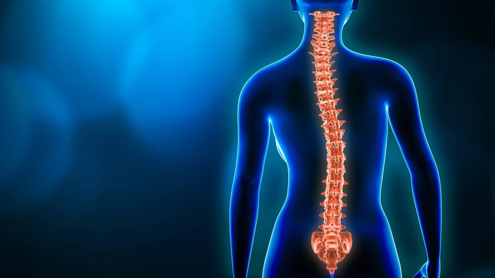 Dextroscoliosis - Curve to the Right